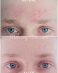 ** Preorder ONLY ** Peptite + Probiotic Face Cream