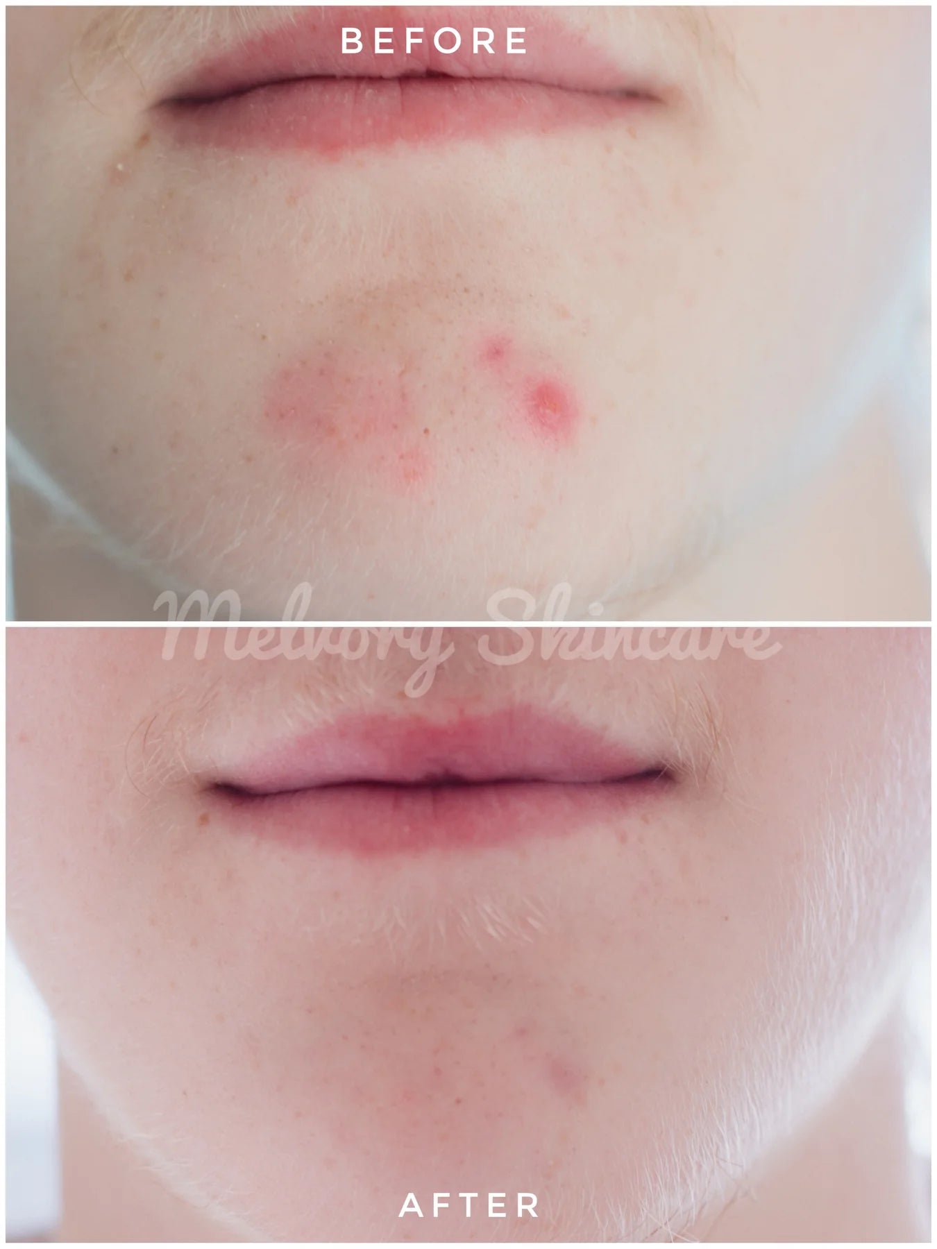 ** Preorder ONLY ** Peptite + Probiotic Face Cream