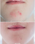 ** Preorder ONLY ** Peptite + Probiotic Face Cream