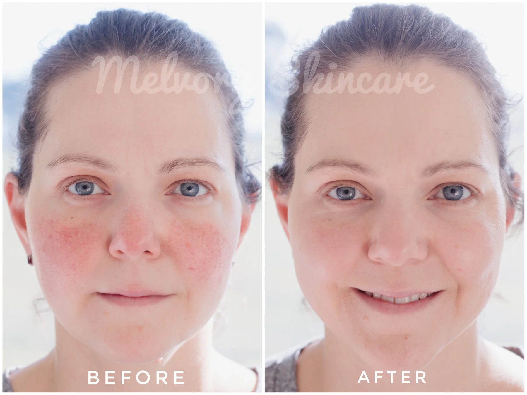 ** Preorder ONLY ** Peptite + Probiotic Face Cream