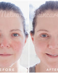 ** Preorder ONLY ** Peptite + Probiotic Face Cream