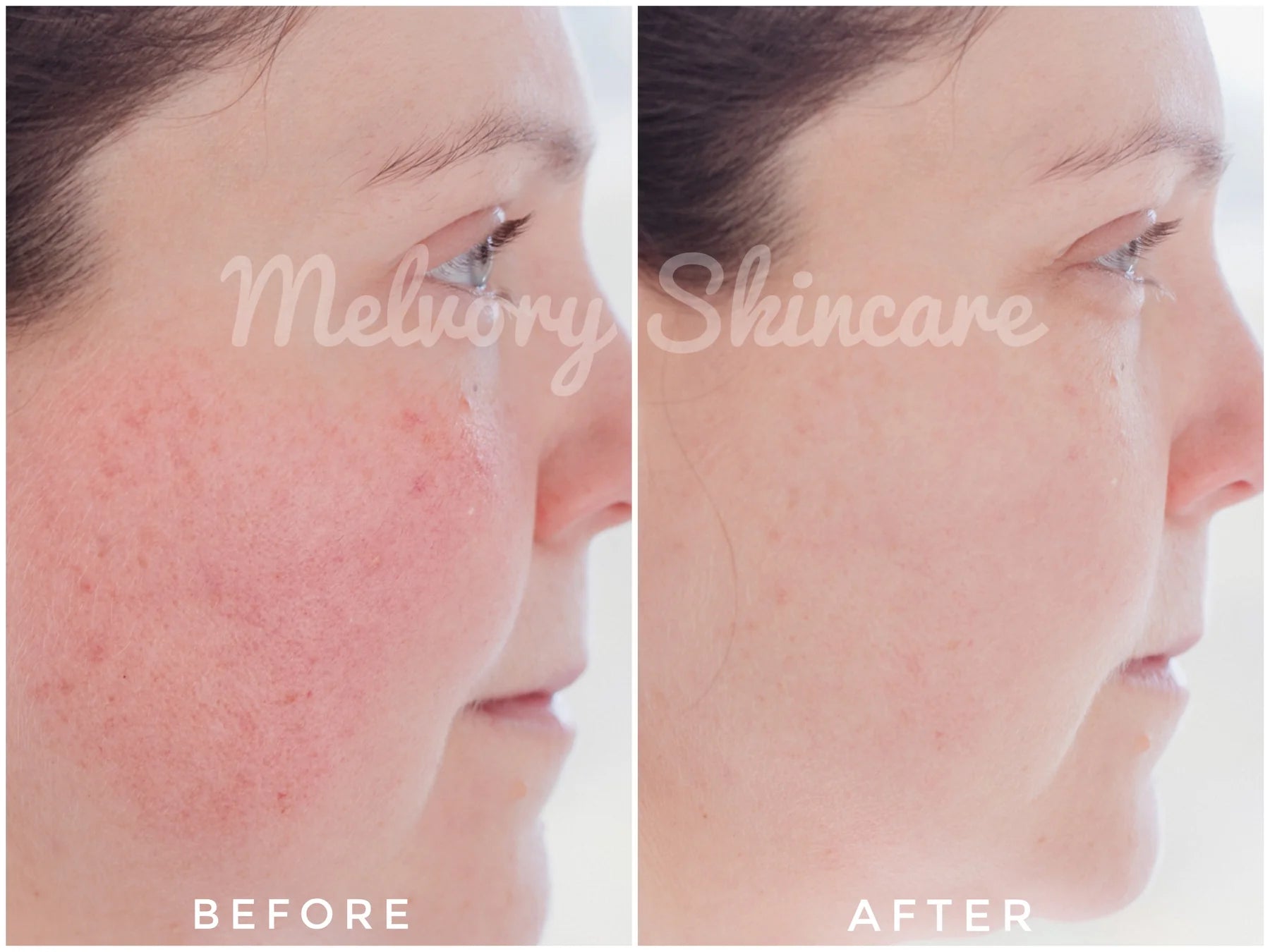 ** Preorder ONLY ** Peptite + Probiotic Face Cream