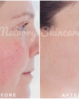 ** Preorder ONLY ** Peptite + Probiotic Face Cream