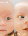 Baby Bum Balm